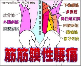 腰痛とセックスについて 【鍼灸師が執筆・監修】